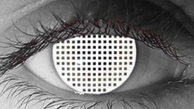 White Lace (Dead Eye) Halloween Contacts